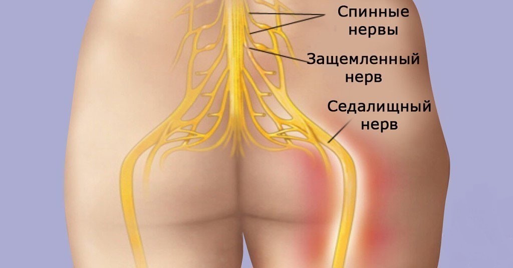 Седалищный нерв картинка где находится